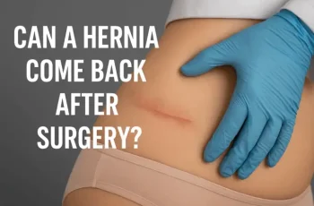 A Hérnia Pode Voltar Após a Cirurgia? Causas e Como Prevenir a Recorrência A Hérnia Pode Voltar Após a Cirurgia? Causas e Como Prevenir a Recorrência