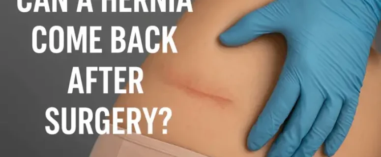 A Hérnia Pode Voltar Após a Cirurgia? Causas e Como Prevenir a Recorrência A Hérnia Pode Voltar Após a Cirurgia? Causas e Como Prevenir a Recorrência